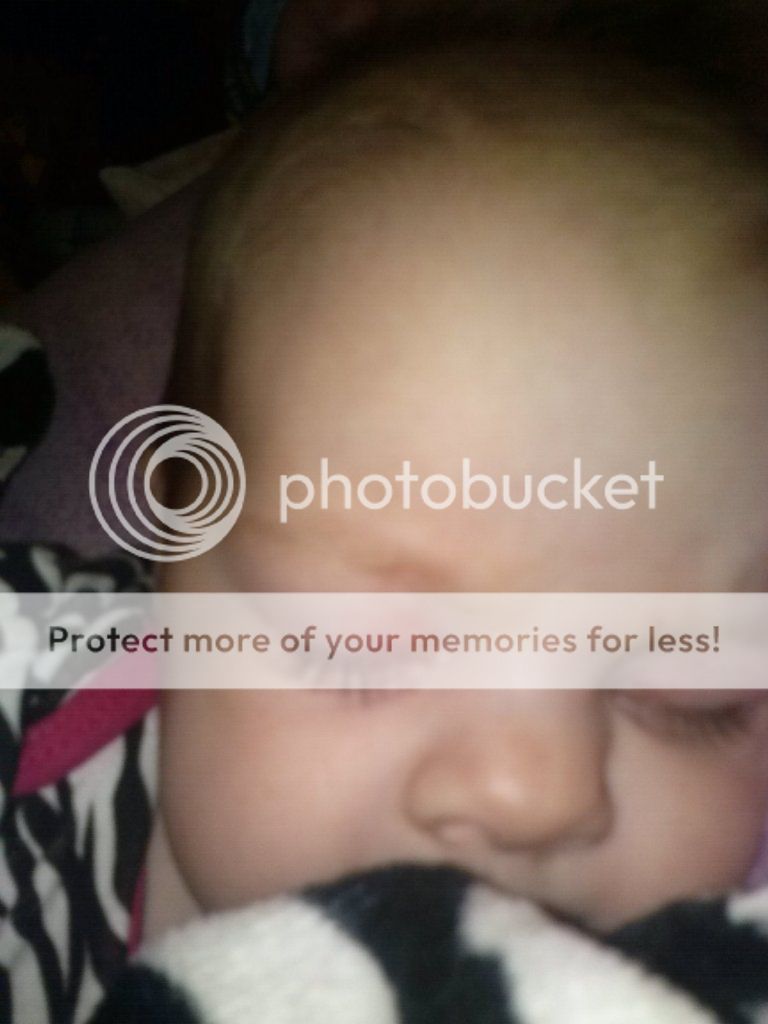 THAT'S a birth mark???!?!?! BabyCenter